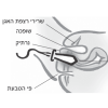 SensaTONE לחיזוק רצפת האגן